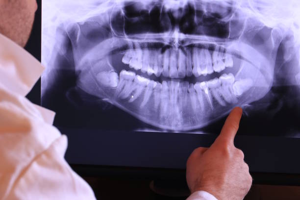 Best Pediatric Emergency Dentist in French Mp, CA