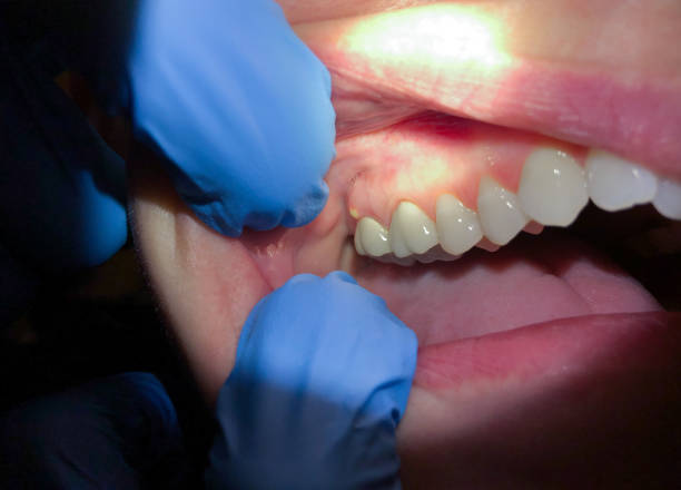 Best Cosmetic Emergency Dentistry in French Mp, CA