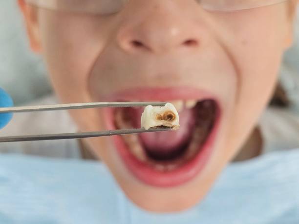  French Mp, CA Emergency Dentist Pros